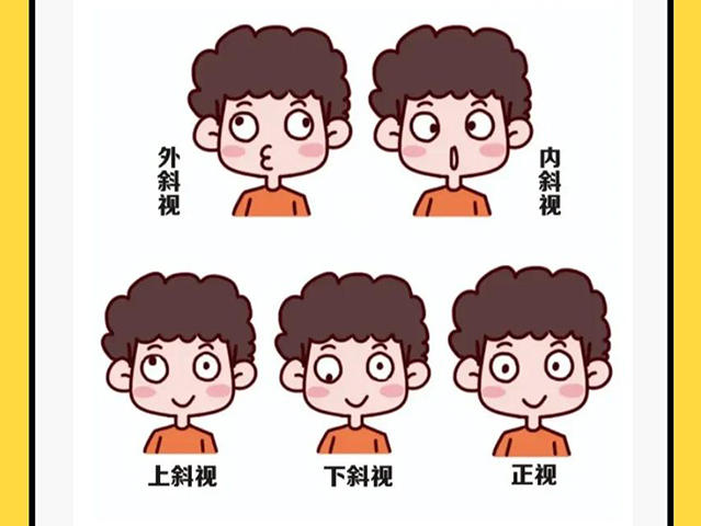 斜视手术